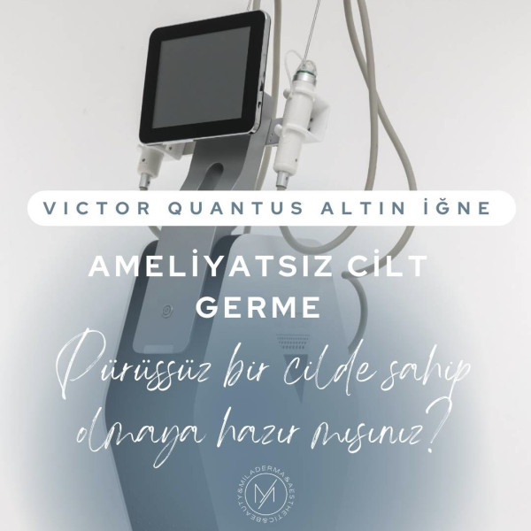 Altın İğne Radyo Frekans
